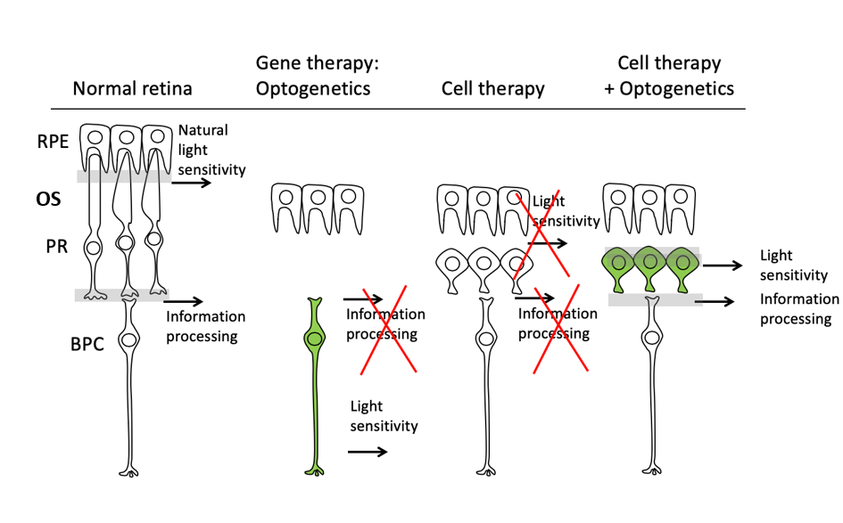 Retina - Gene Vision